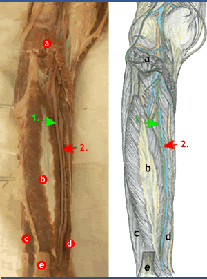 posterior tibial artery. Posterior tibial artery
